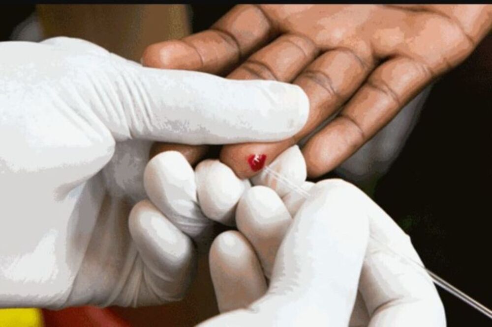 Uganda: Imibare y'abandura virusi itera SIDA ikomeje gutumbagira