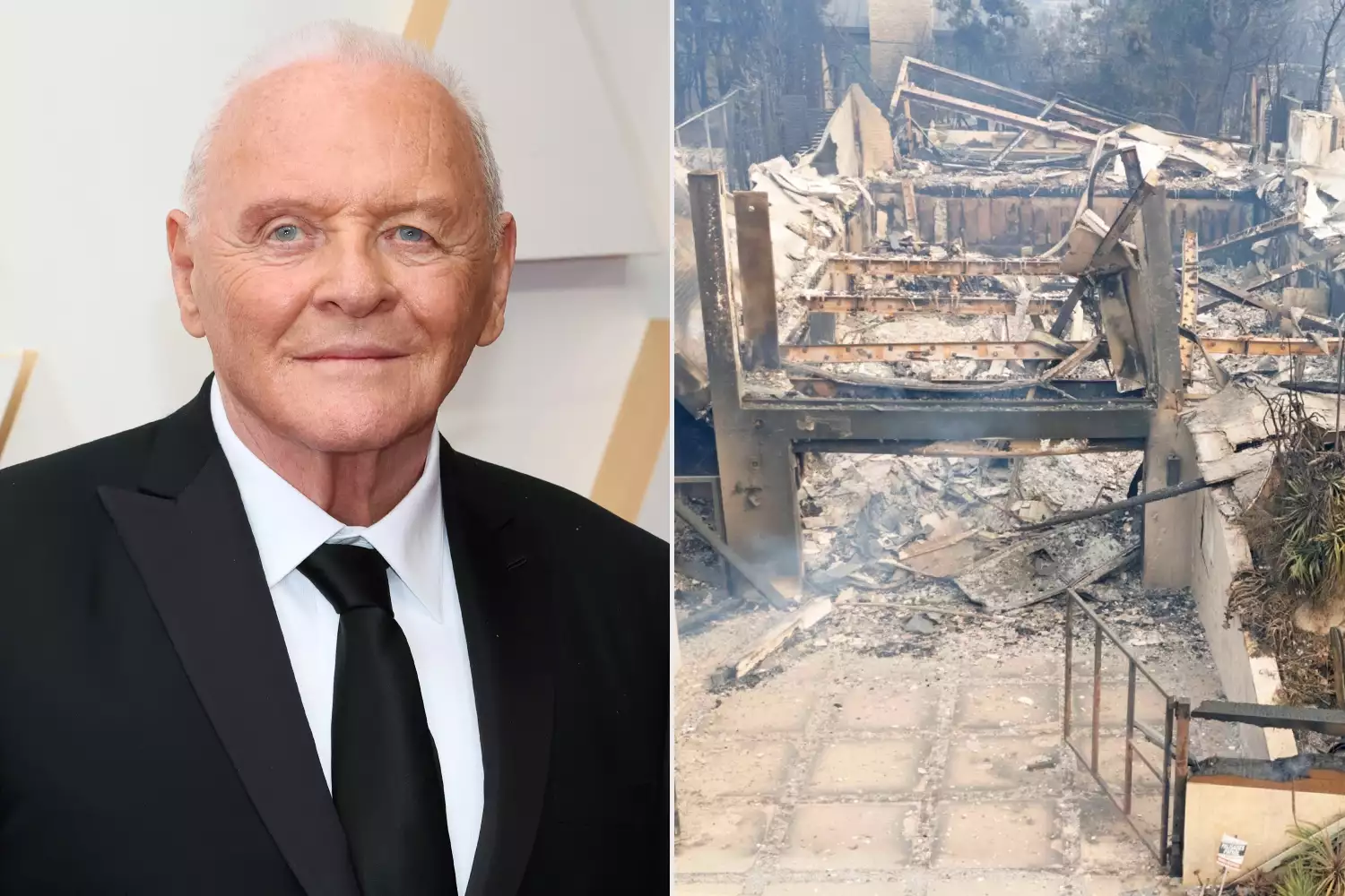 anthony hopkins home los angeles fire 010925 73fc33f35aaf4338bf381b76690cd9c5