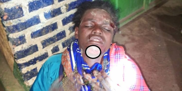 Akananwa yagakuyeho 1 750x375 1