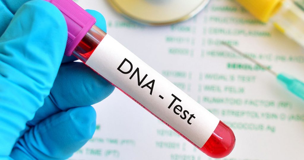 Uganda Warns: Don't Take DNA Tests Unless You Have a Strong Heart 19 DNATest.Dreamstime 1024x538 1024x538 1