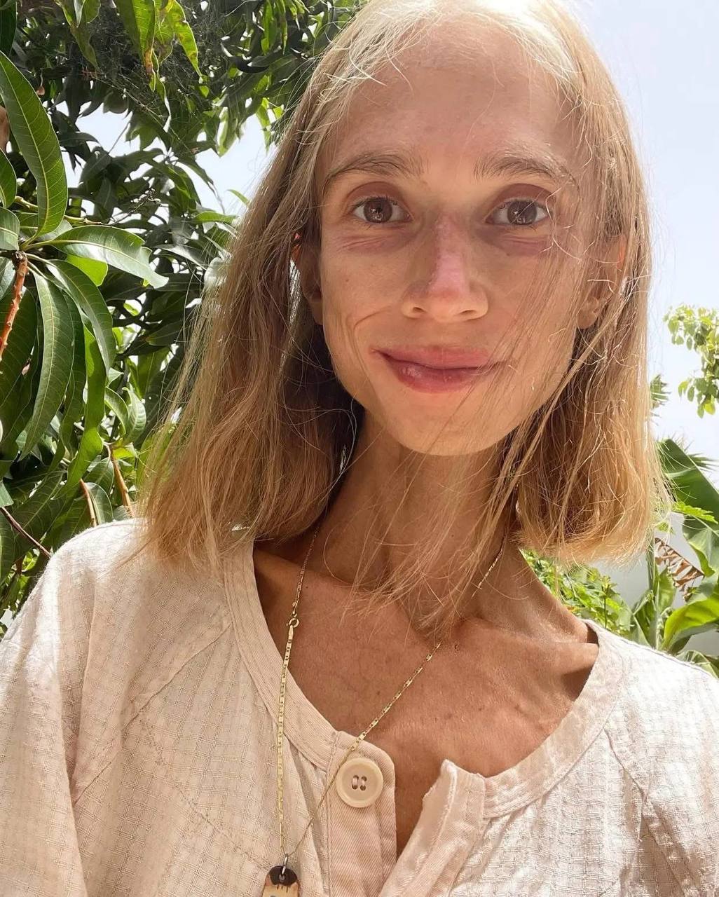 Yishwe n'inzara nyuma yo kwiha ibyo kurya imbuto gusa 40 20251008 104201