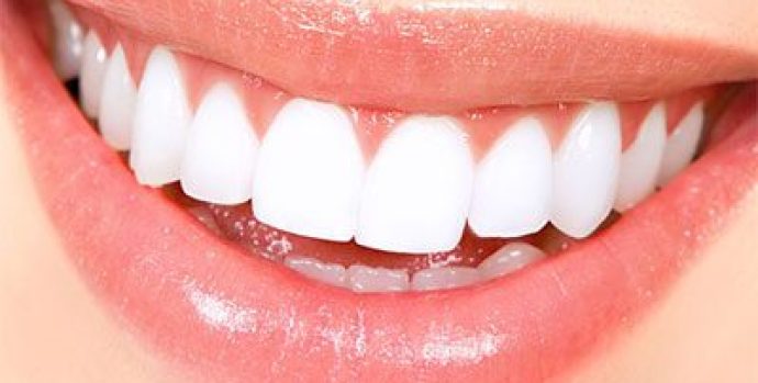 teeth-whitening