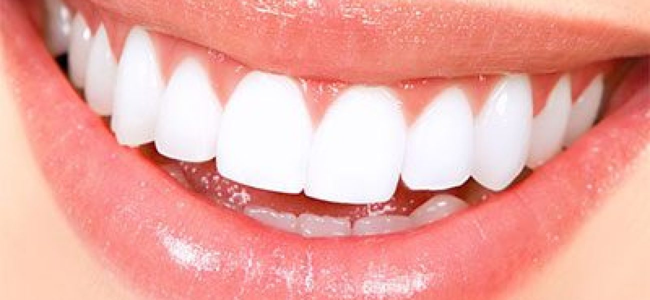 teeth-whitening